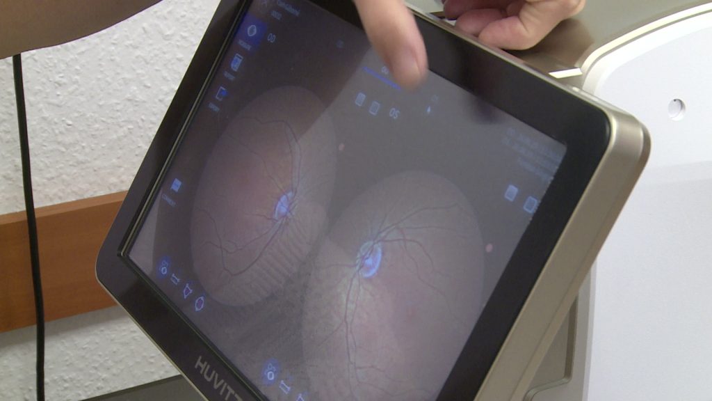 Új fundus kamerával bővült egy gyöngyösi optika