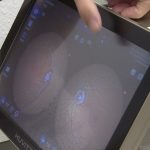 Új fundus kamerával bővült egy gyöngyösi optika